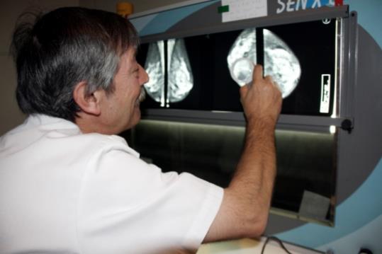 Un metge analitzant una radiografia de mama; es recomana fer una mamografia cada dos anys, per permetre el diagnòstic precoç. ACN
