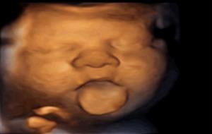Imatge d'un fetus traient la llengua per l'estimulació musical rebuda. Institut Marquès
