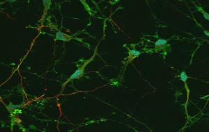 Cultiu de neurones humanes emprat en els estudis. ACN