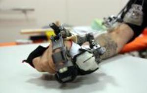 En Sergio, un pacient de l'Institut Guttmann, mostra la ma robòtica desenvolupada per investigadors alemanys i italians