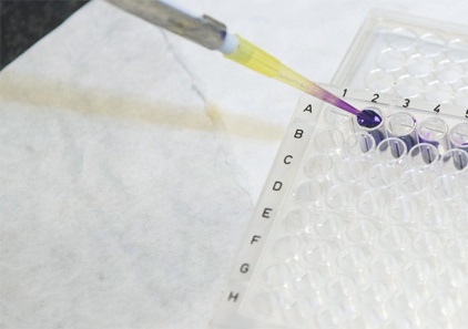Institut d’Investigació Biomèdica de Bellvitge. EIX
