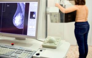 Una dona es fa una mamografia per detectar si té càncer de mama. I. Assistència Sanitària