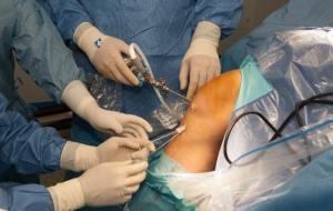 Una nova cirurgia que implanta teixit porcí pot revolucionar el tractament del trencament del lligament encreuat anterior del genoll