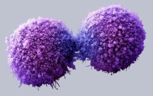 Cèl·lules de pàncrees canceroses completant la divisió cel·lular. ACN