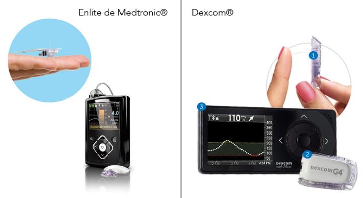 Salut finançarà els dispositius de monitoratge continu de glucosa a tots els menors de 18 anys amb diabetis tipus 1. Fundación Diabetis