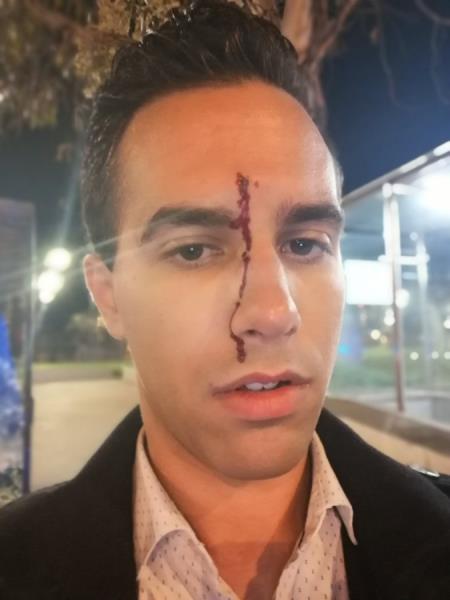 El periodista de Calafell Xavier Martínez denuncia una agressió homòfoba al parc de Joan Miró de Barcelona. Xavier Martínez