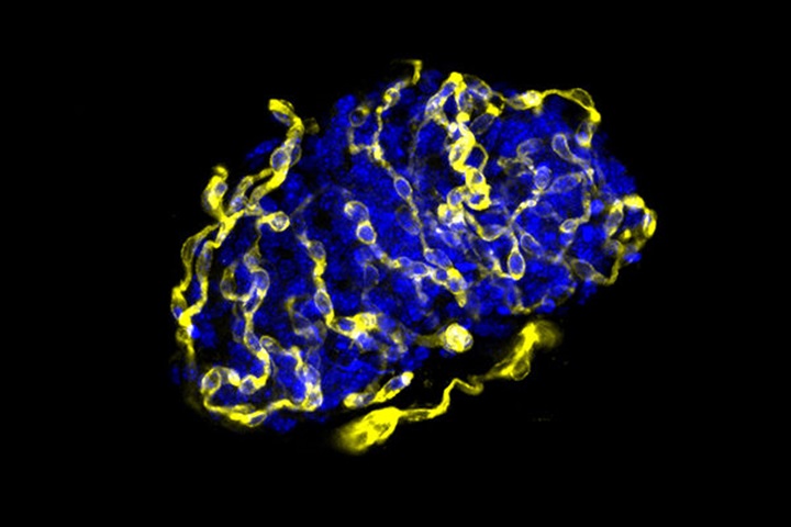 Identifiquen un mecanisme per millorar el trasplantament d’illots pancreàtics en diabetis tipus 1. EIX