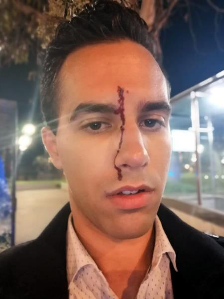 Primer pla del periodista del Canal Blau Xavi Martínez amb un trau sagnant al front després d'haver patit una agressió homòfoba al parc de Joan Miró. 