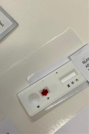 Pla obert d'un test serològic amb una gota de sang que marcarà si la persona és immune o no al coronavirus el 22 d'abril de 2020. Fundació Hospital d'