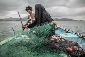 Fotografia de Pablo Tosco 'Yemen: Hunger, Another War Wound', guanyadora del primer premi a la categoria Temes Contemporanis, Fotografies Individuals,