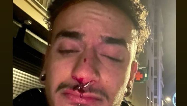L'OCH denuncia una agressió a un jove gai a Calafell al crit de 'bujarra de merda'. EIX