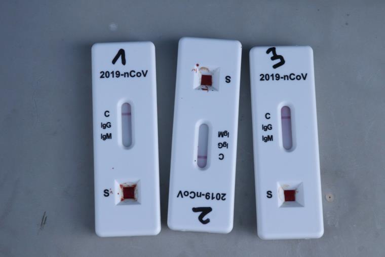 Pla detall d'uns tests d'antígens que han donat negatiu. ACN