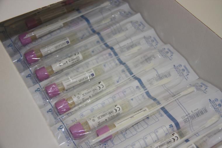 Primer pla de proves PCR. ACN
