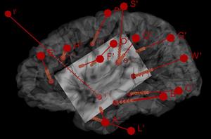 Un estudi descobreix com l'estimulació d'una part del cervell fa variar l'activitat del cor. EIX