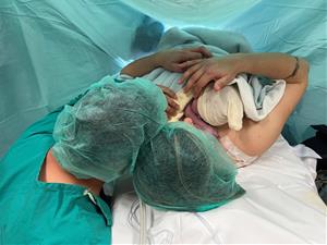 L'hospital de Sant Camil realitza la primera cesària assistida per la mare. CSAPG