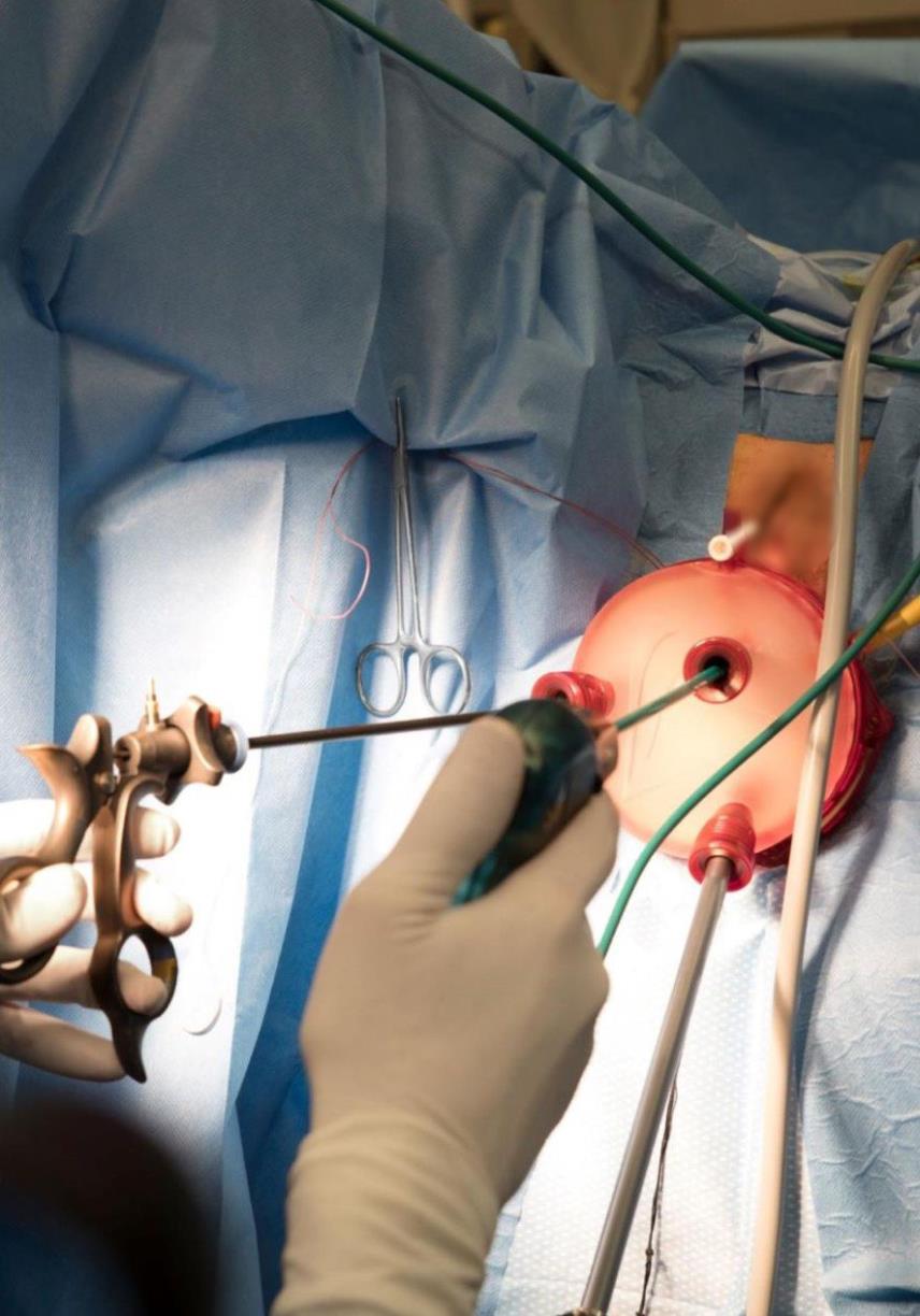 El Consorci Sanitari Alt Penedès-Garraf impulsa una cirurgia ginecològica innovadora. CSAPG