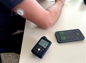 El Consorci Sanitari Alt Penedès-Garraf incorpora bombes d’insulina intel·ligents per a la diabetis tipus 1. CSAPG