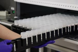 Es diagnostiquen 43.633 nous casos de càncer el 2025 a Catalunya i moren 17.696 persones per la malaltia. ACN